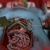 Surgeon Simulator 2013 Steam Key GLOBAL - Image 3